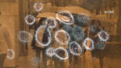 武漢肺炎有多毒？　重症如「SARS加AIDS」